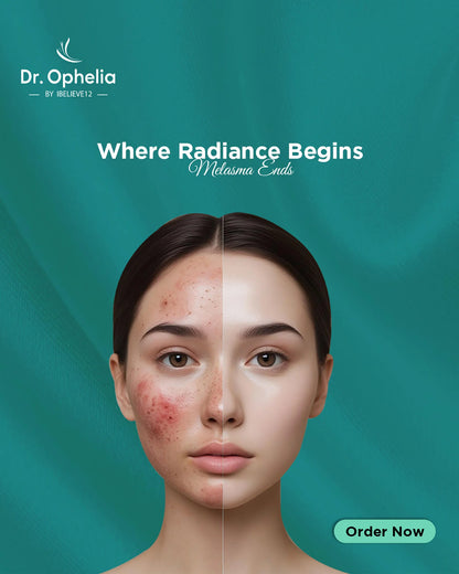 Anti Melasma Cream